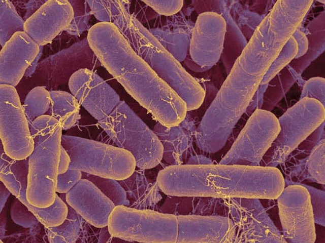 Bacterias del género bacteroides, muy abundante en la materia fecal Bacterias del género bacteroides, muy abundante en la materia fecal