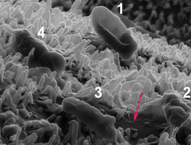 Superficie nano-texturada del ala de una libélula. Nanopilares largos y cortos, contenido celular, bacterias muertas Superficie nano-texturada del ala de una libélula. Nanopilares largos y cortos, contenido celular, bacterias muertas