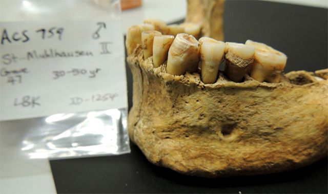 Un espécimen más del estudio de Alan Cooper, fotografiado por él mismo Dentadura y placa dental antigua