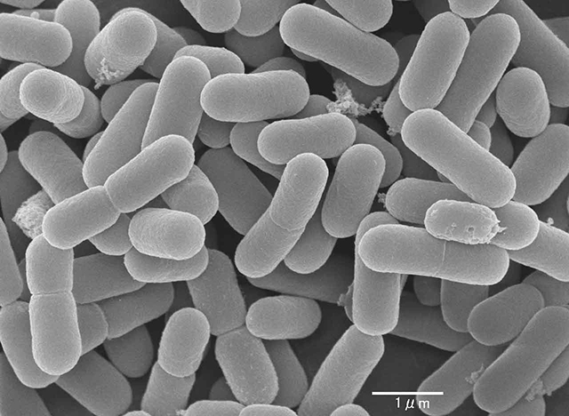 Lactobacillus reuteri, microorganismo que suele formar parte del microbioma de personas sanas. Algunas cepas de L. reuteri se emplean como probióticos para ayudar a combatir ciertas infecciones Lactobacillus reuteri