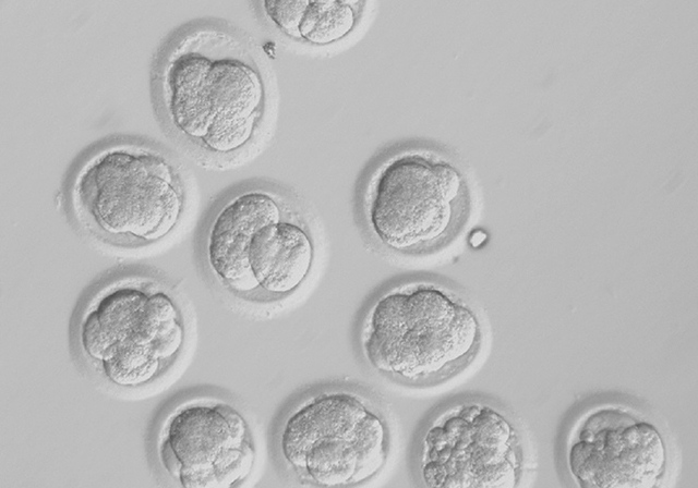 Embriones humanos clonados. Por primera vez se han obtenido células madre humanas mediante la clonación. (c) Universidad de Salud y Ciencia de Oregón / AP embriones clonados