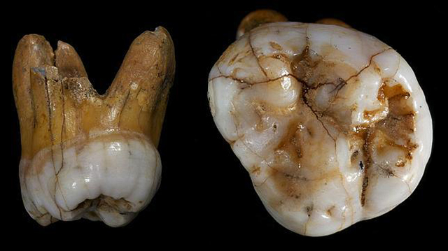 Muela de un homínido de Denisova. Fue encontrada en un área donde vivieron tanto neandertales como sapiens, aunque su forma y su ADN no pertenece a ninguno de ellos. (c) Instituto Max Planck de Antropología Evolutiva Fósil de una muela
