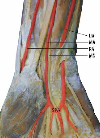 Arteria satélite del nervio mediano en tejido cadavérico