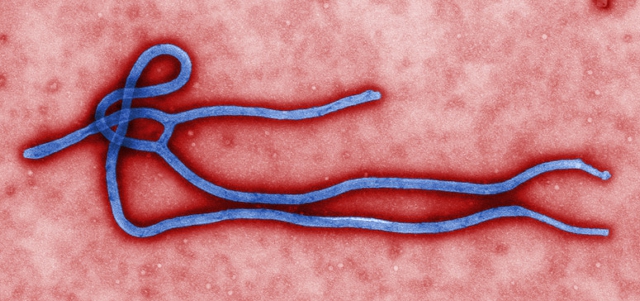 Micrografía electrónica colorizada del virión del ébola