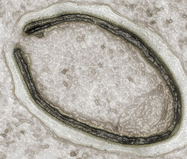 Pandoravirus salinus